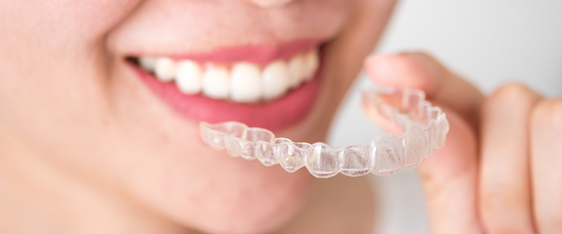 How much do invisalign payments cost per month?