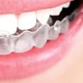 What is the lowest price for invisalign?