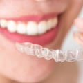 What does it mean when your invisalign doesn't fit?