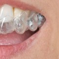 Is Invisalign more painful than braces?