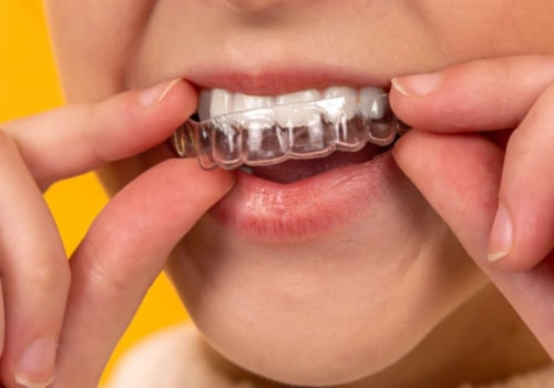 Is invisalign better or better braces?